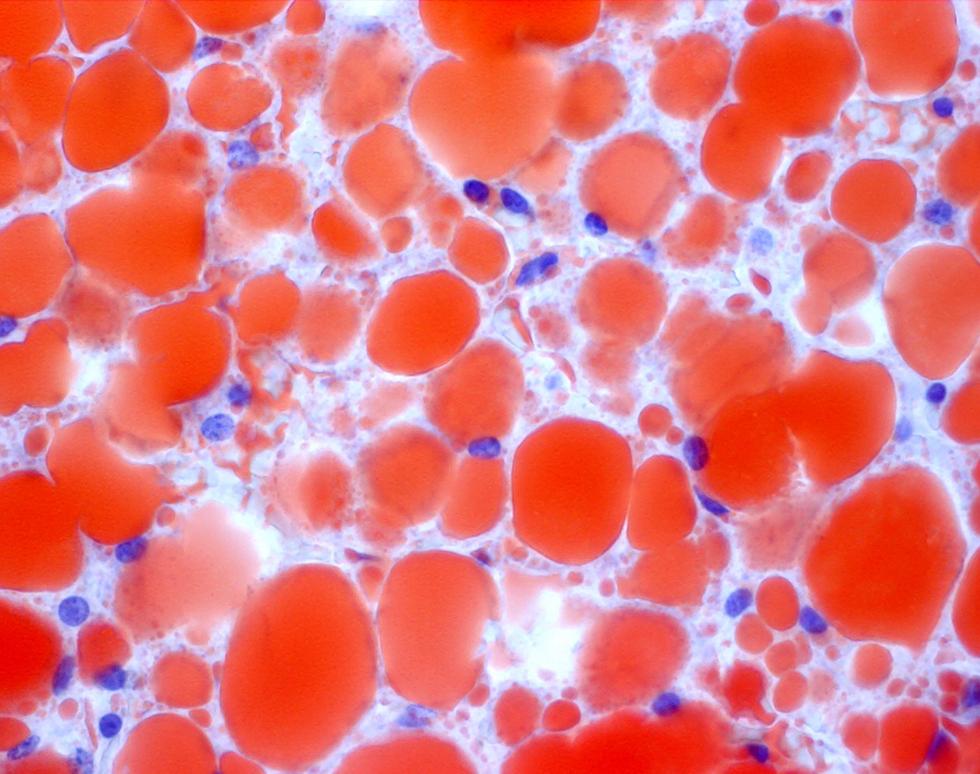 Lady Larva - Hilary Meyers